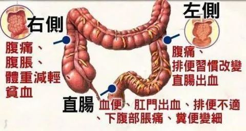 我院普外科成功开展一例腹腔镜下升结肠恶性肿瘤根治性切除手术