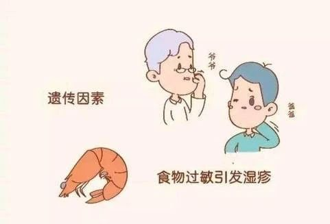 健康科普难根治的湿疹