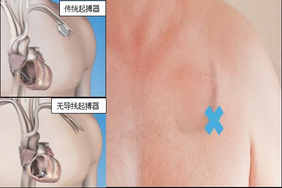 817_1597042817000.jpg-cgwapimg