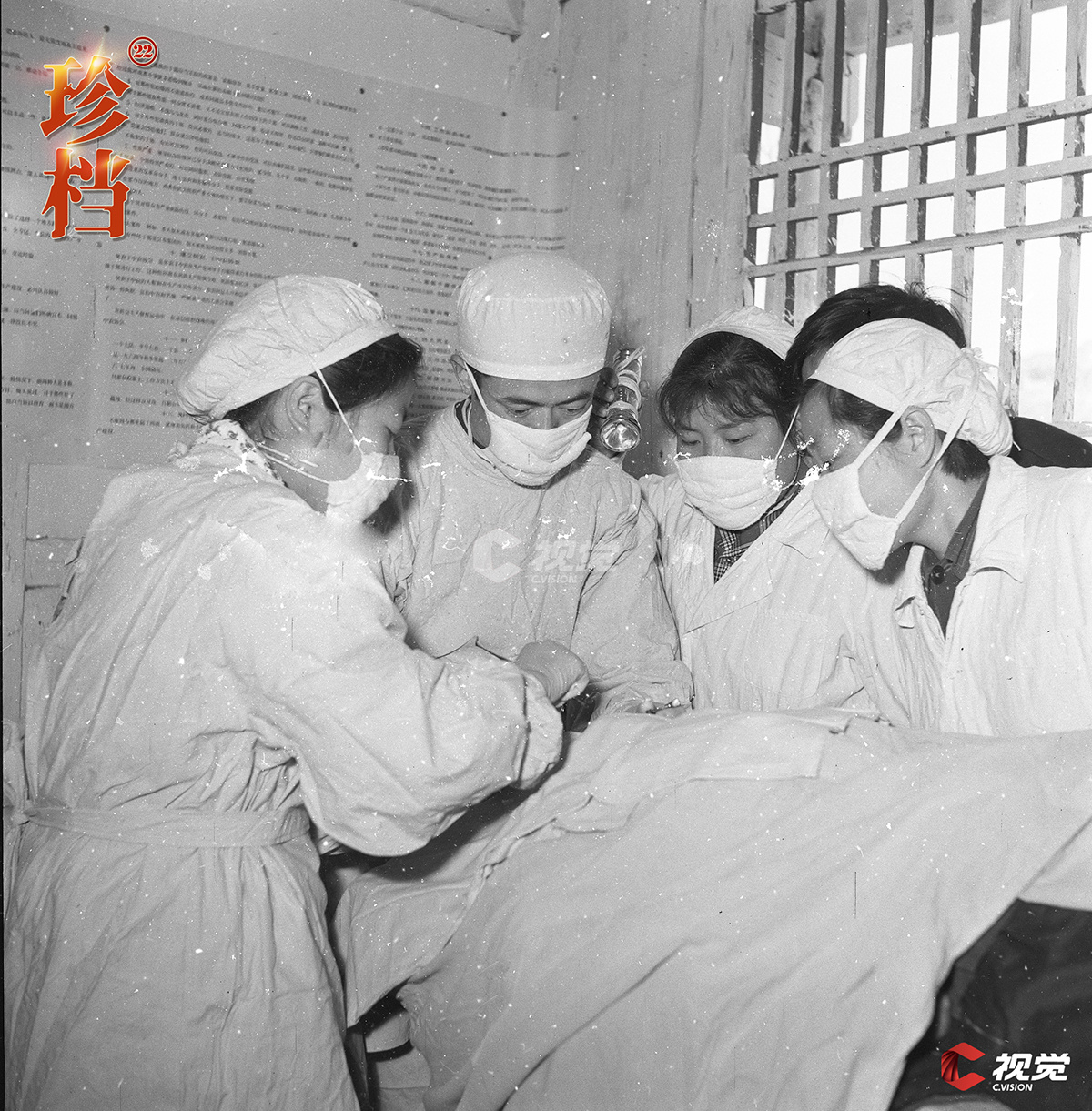 1965年, 四川医学院的专家,教授在三台县简陋的手术室里给病人做手术