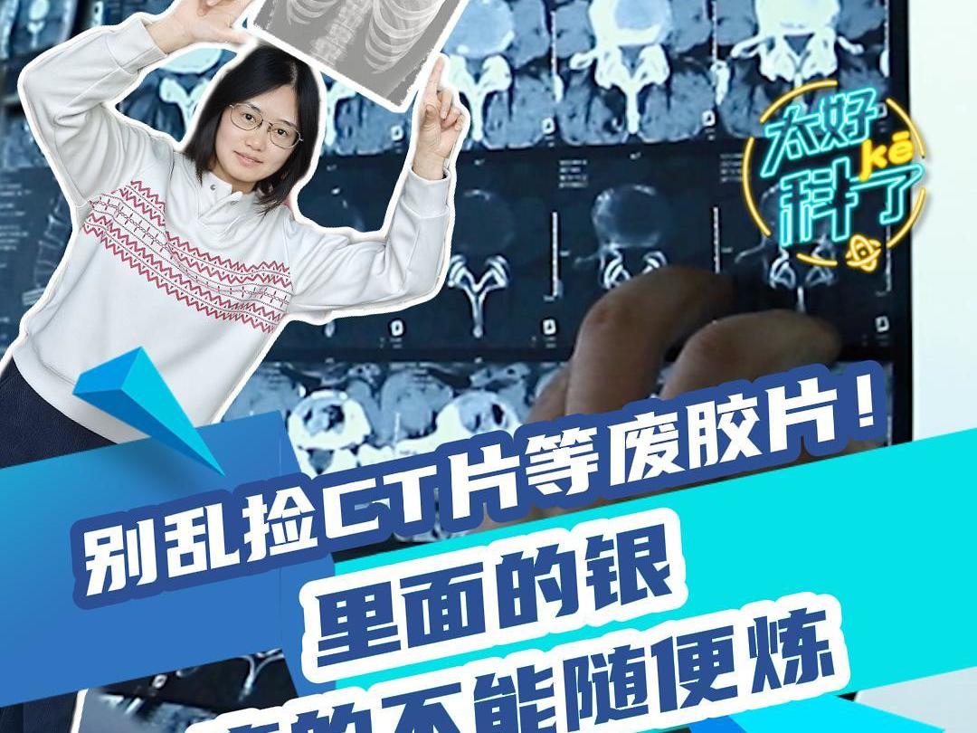 别乱捡CT片等废胶片！里面的银，真的不能随便炼丨太好“科”了